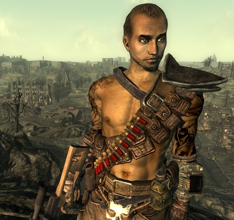 Receding Hair